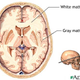 Image for article titled Is your depression caused by brain inflammation?